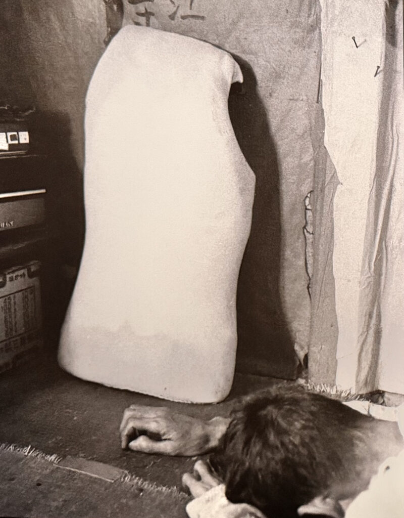 N's white plaster cast.